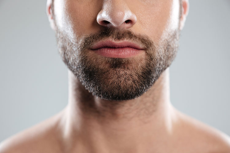 beard-transplant
