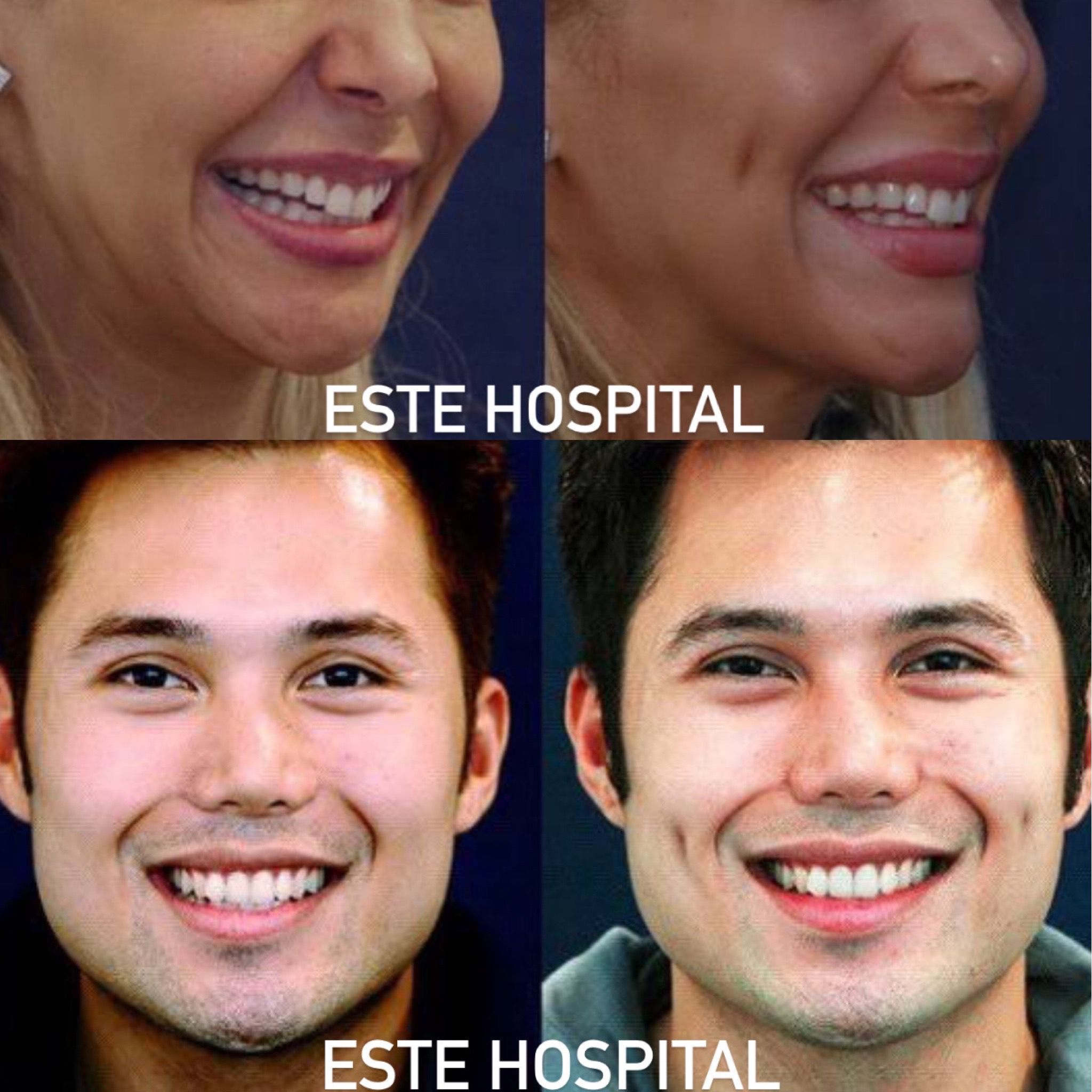 demple-surgery
