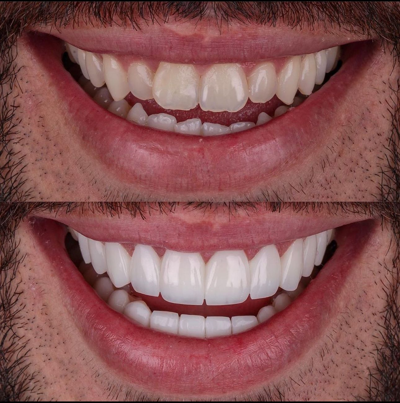teeth2